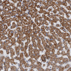 Anti-MDH2 Antibody