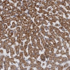 Immunohistochemical staining of human liver shows strong positivity in cytoplasm granular in hepatocytes.
