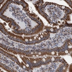 Immunohistochemical staining of human duodenum shows strong positivity in cytoplasm granular in glandular cells.