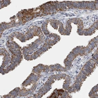 Immunohistochemical staining of human fallopian tube shows strong positivity in cytoplasm granular in glandular cells.