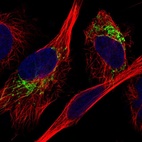 Anti-MDH2 Antibody