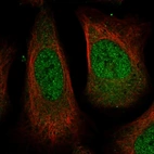 Immunofluorescent staining of human cell line U-2 OS shows localization to nucleoplasm.