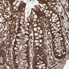 Immunohistochemical staining of human Rectum shows strong membranous and cytoplasmic positivity in glandular cells.
