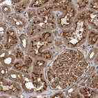 Immunohistochemical staining of human Kidney shows strong membranous and cytoplasmic positivity in cells in tubules and glomeruli.