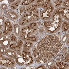 Immunohistochemical staining of human Kidney shows strong membranous and cytoplasmic positivity in cells in tubules and glomeruli.