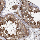 Immunohistochemical staining of human Testis shows strong membranous and cytoplasmic positivity in Leydig cells and cells in seminiferous ducts.