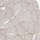 Immunohistochemical staining of human Skeletal muscle shows very weak cytoplasmic positivity in myocytes.