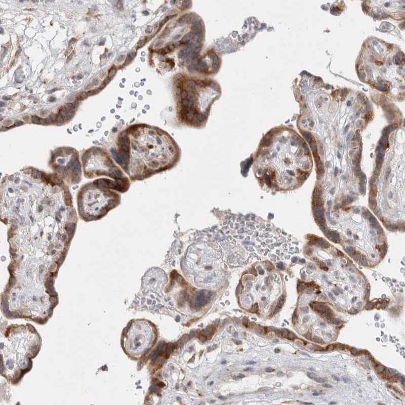 Anti-TRMT1L Antibody