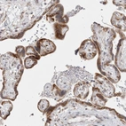 Anti-TRMT1L Antibody
