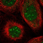 Immunofluorescent staining of human cell line A-431 shows localization to nucleus & nucleoli.