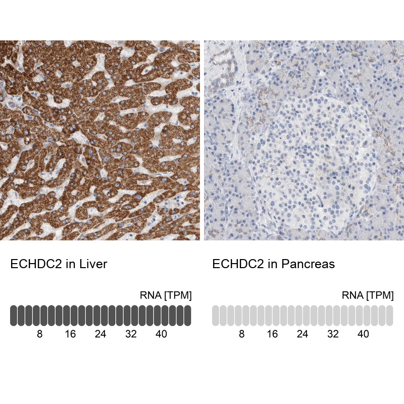 Anti-ECHDC2 Antibody