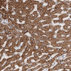 Immunohistochemical staining of human liver shows high expression.
