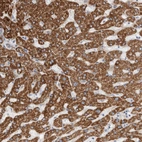 Immunohistochemical staining of human liver shows high expression.