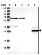 Lane 1: Marker [kDa] 230, 130, 95, 72, 56, 36, 28, 17, 11_br/_Lane 2: Human cell line RT-4_br/_Lane 3: Human cell line U-251MG sp_br/_Lane 4: Human plasma (IgG/HSA depleted)_br/_Lane 5: Human liver tissue