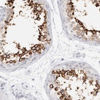 Immunohistochemical staining of human testis shows high expression.