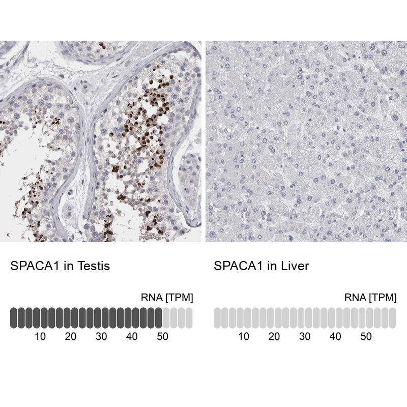 Anti-SPACA1 Antibody
