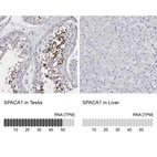 Anti-SPACA1 Antibody