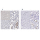 Immunohistochemical staining of human cerebral cortex, kidney, liver and testis using Anti-SPACA1 antibody HPA026744 (A) shows similar protein distribution across tissues to independent antibody HPA043297 (B).
