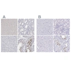Immunohistochemical staining of human cerebral cortex, kidney, liver and testis using Anti-SPACA1 antibody HPA026744 (A) shows similar protein distribution across tissues to independent antibody HPA043297 (B).