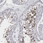 Immunohistochemical staining of human Testis shows strong cytoplasmic positivity in cells in seminiferous ducts.
