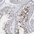Immunohistochemical staining of human Testis shows strong cytoplasmic positivity in cells in seminiferous ducts.