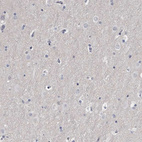 Immunohistochemical staining of human Cerebral cortex shows no positivity in neuronal cells as expected.