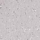 Immunohistochemical staining of human Cerebral cortex shows no positivity in neuronal cells as expected.