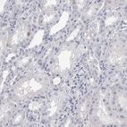 Immunohistochemical staining of human Kidney shows no positivity in cells in tubules as expected.