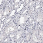 Immunohistochemical staining of human Kidney shows no positivity in cells in tubules as expected.
