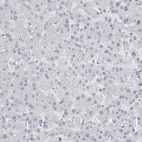 Anti-SPACA1 Antibody
