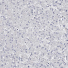 Immunohistochemical staining of human Liver shows no positivity in hepatocytes as expected.