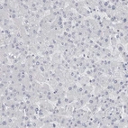 Immunohistochemical staining of human Liver shows no positivity in hepatocytes as expected.