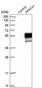 Western blot analysis in control (vector only transfected HEK293T lysate) and SPACA1 over-expression lysate (Co-expressed with a C-terminal myc-DDK tag (~3.1 kDa) in mammalian HEK293T cells, LY410624).