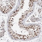 Immunohistochemical staining of human testis shows moderate to strong nuclear positivity in cells in seminiferous ducts.