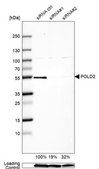 Anti-POLD2 Antibody