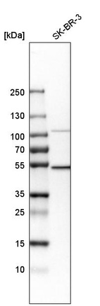 Western blot analysis in human cell line SK-BR-3.