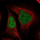 Immunofluorescent staining of human cell line U-2 OS shows localization to nucleoplasm.