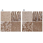 Anti-TRMT61B Antibody