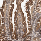 Immunohistochemical staining of human duodenum shows strong granular cytoplasmic positivity in glandular cells.