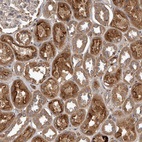 Immunohistochemical staining of human kidney shows strong granular cytoplasmic positivity in cells in tubules.