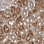 Immunohistochemical staining of human kidney shows strong granular cytoplasmic positivity in cells in tubules.