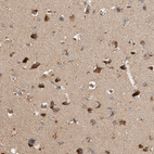 Immunohistochemical staining of human cerebral cortex shows strong granular cytoplasmic positivity in neuronal cells.