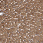 Immunohistochemical staining of human liver shows moderate to strong granular cytoplasmic positivity in hepatocytes.