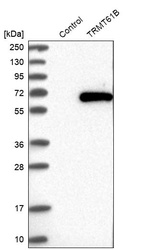 Anti-TRMT61B Antibody