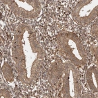 Immunohistochemical staining of human endometrium shows low expression as expected.