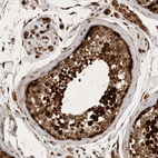 Immunohistochemical staining of human testis shows high expression.