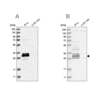 Western blot analysis using Anti-FAM221A antibody HPA026748 (A) shows similar pattern to independent antibody HPA026752 (B).