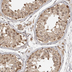 Anti-ASPSCR1 Antibody