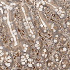 Anti-ASPSCR1 Antibody