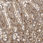 Immunohistochemical staining of human duodenum shows moderate cytoplasmic positivity in glandular cells.
